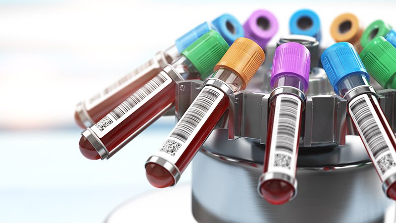 Hormone Replacement Therapy in Chandler, AZ