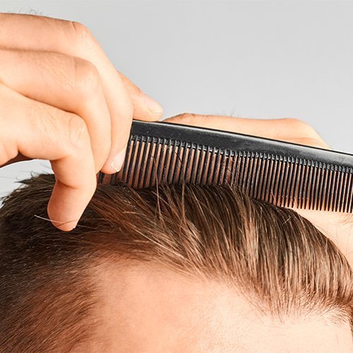 Microneedling for hair loss | VIA Medspa in Chandler