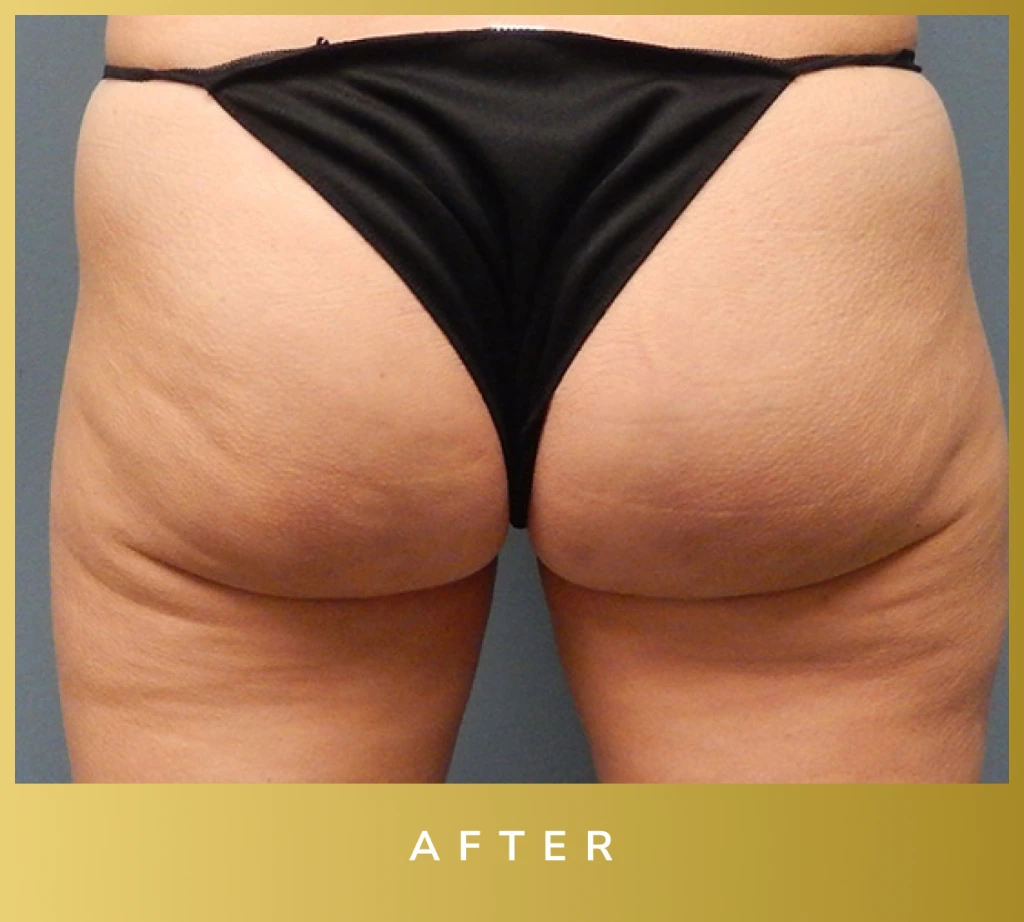 before and after - After Banner