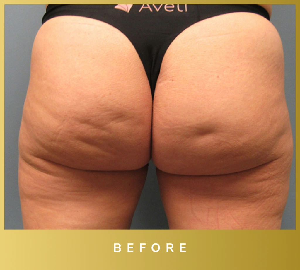 before and after - Before Banner