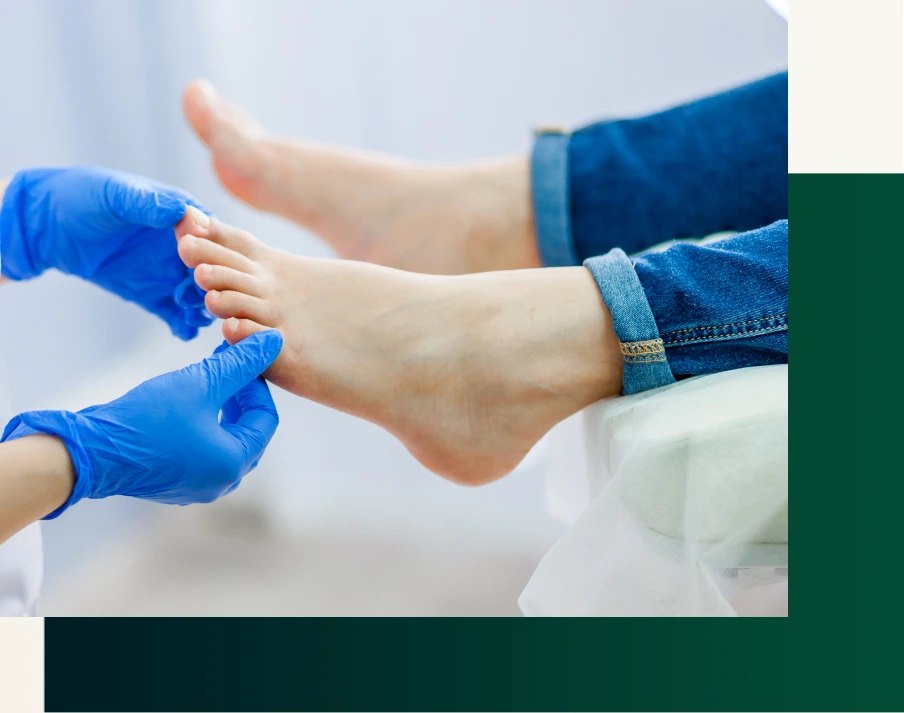Candidates for Toenail Fungus Laser Treatment Banner