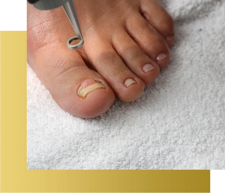 Laser Treatment Procedure: Step-by-Step Banner